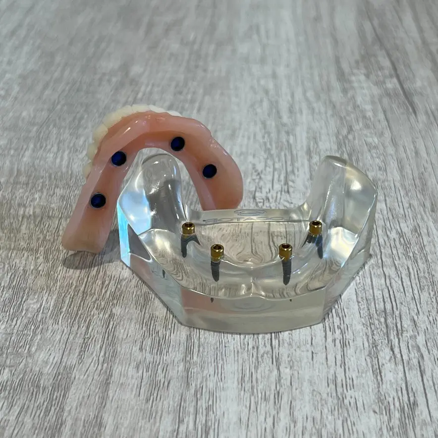 snap-in implant dentures Danbury, CT